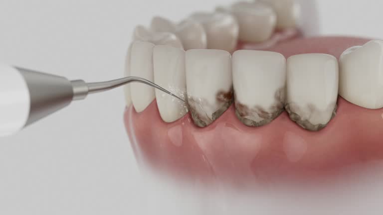 Reliable Dental Implants contractor in Lakehurst, NJ by Smile Center Dentistry